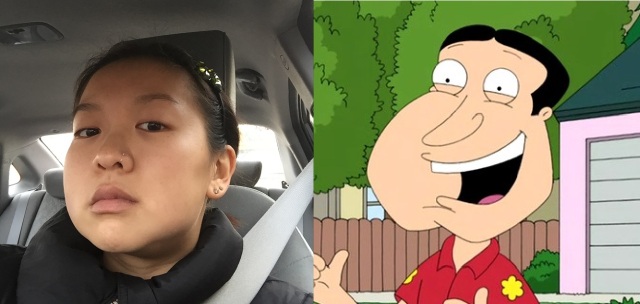 The lower part of my face has been swollen for days. I look like Quagmire from Family Guy!